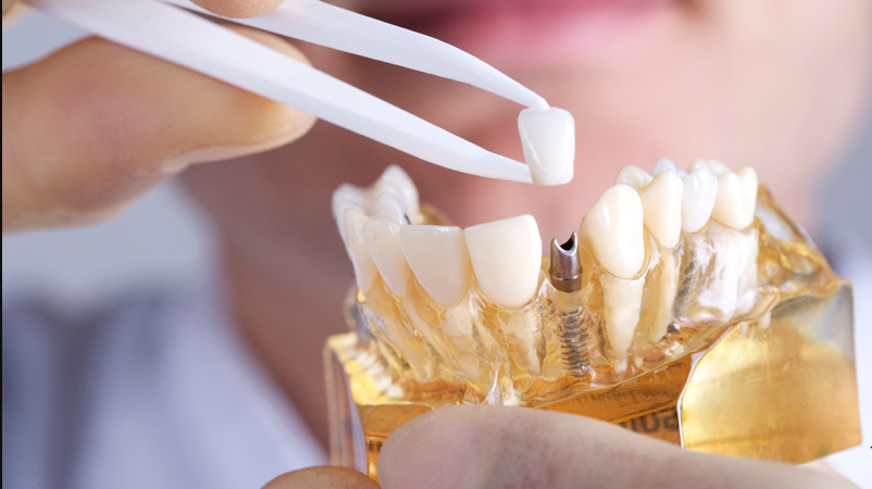 Best Dental Practices