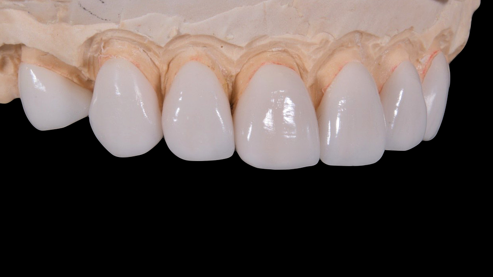 Dental Services