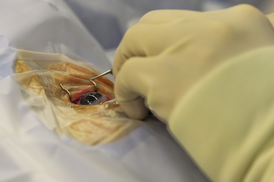 Lasik eye surgery
